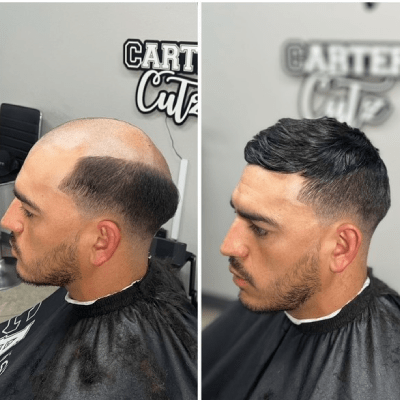 MEN'S HAIR UNITS